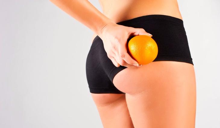 МИФЫ о ЦЕЛЛЮЛИТЕ, в которые мы все еще верим